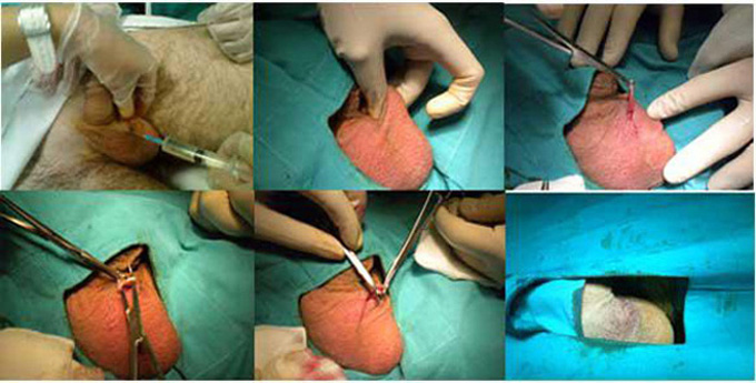 Esplorazione digito-rettale Esplorazione digito-rettale